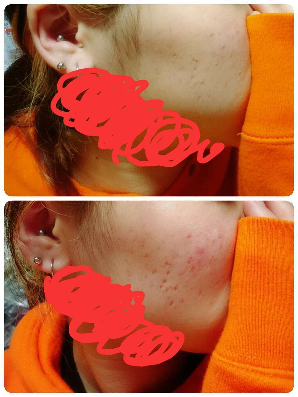 ピディット クリアスムースパウダー(旧)/pdc/プレストパウダーを使ったクチコミ(2枚目)