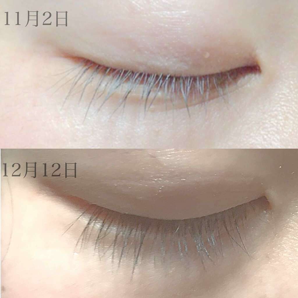 スカルプD ボーテ ピュアフリーアイラッシュセラム/アンファー(スカルプD)/まつげ美容液を使ったクチコミ（2枚目）