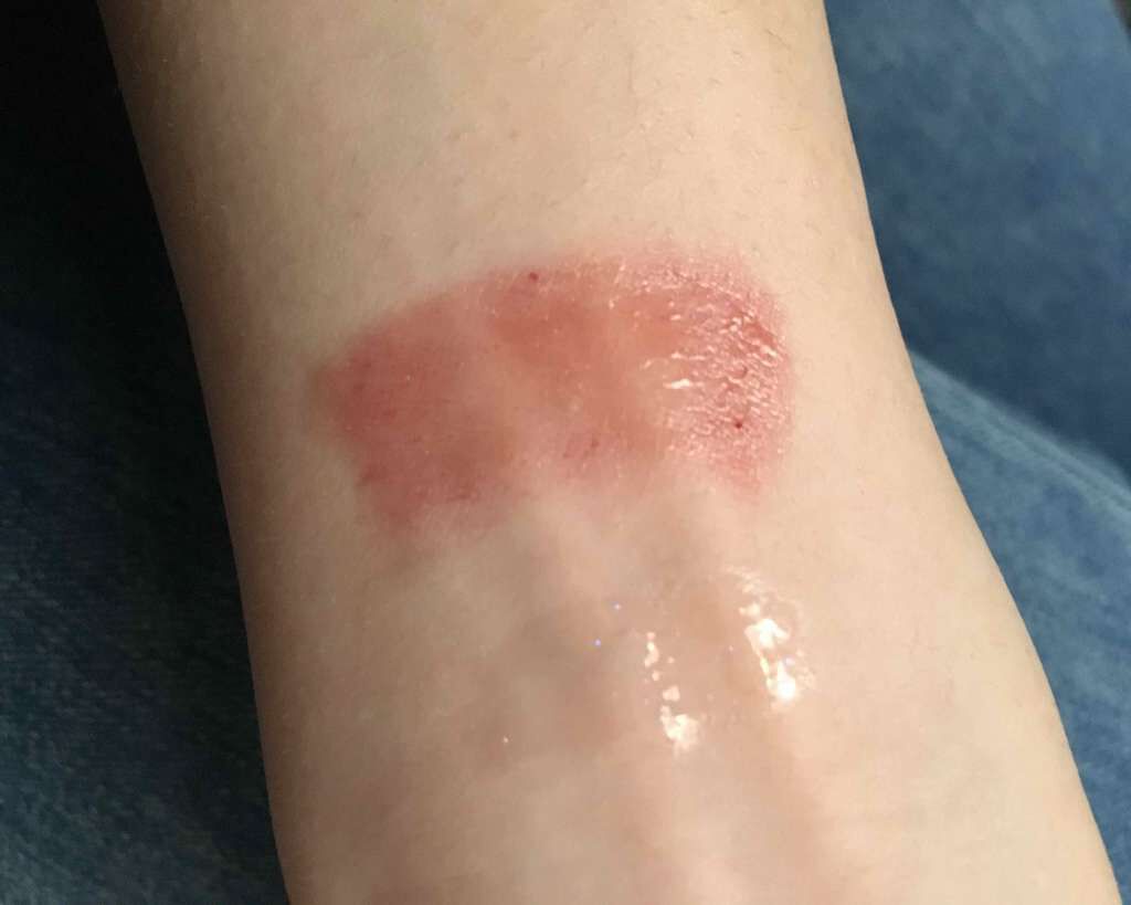 リップケアオイル/excel/リップグロスを使ったクチコミ(3枚目)