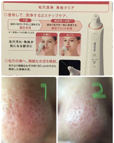 パナソニック 毛穴吸引 美顔器 | web-flake.com
