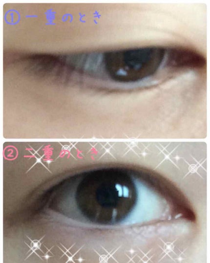 アイトーク/アイトーク/二重まぶた用アイテムを使ったクチコミ(2枚目)