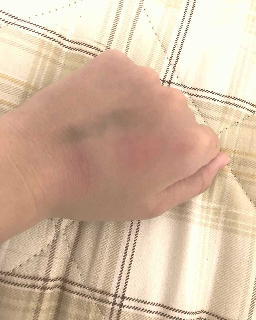 スポッツコンシーラー/インテグレート/リキッドコンシーラーを使ったクチコミ(3枚目)