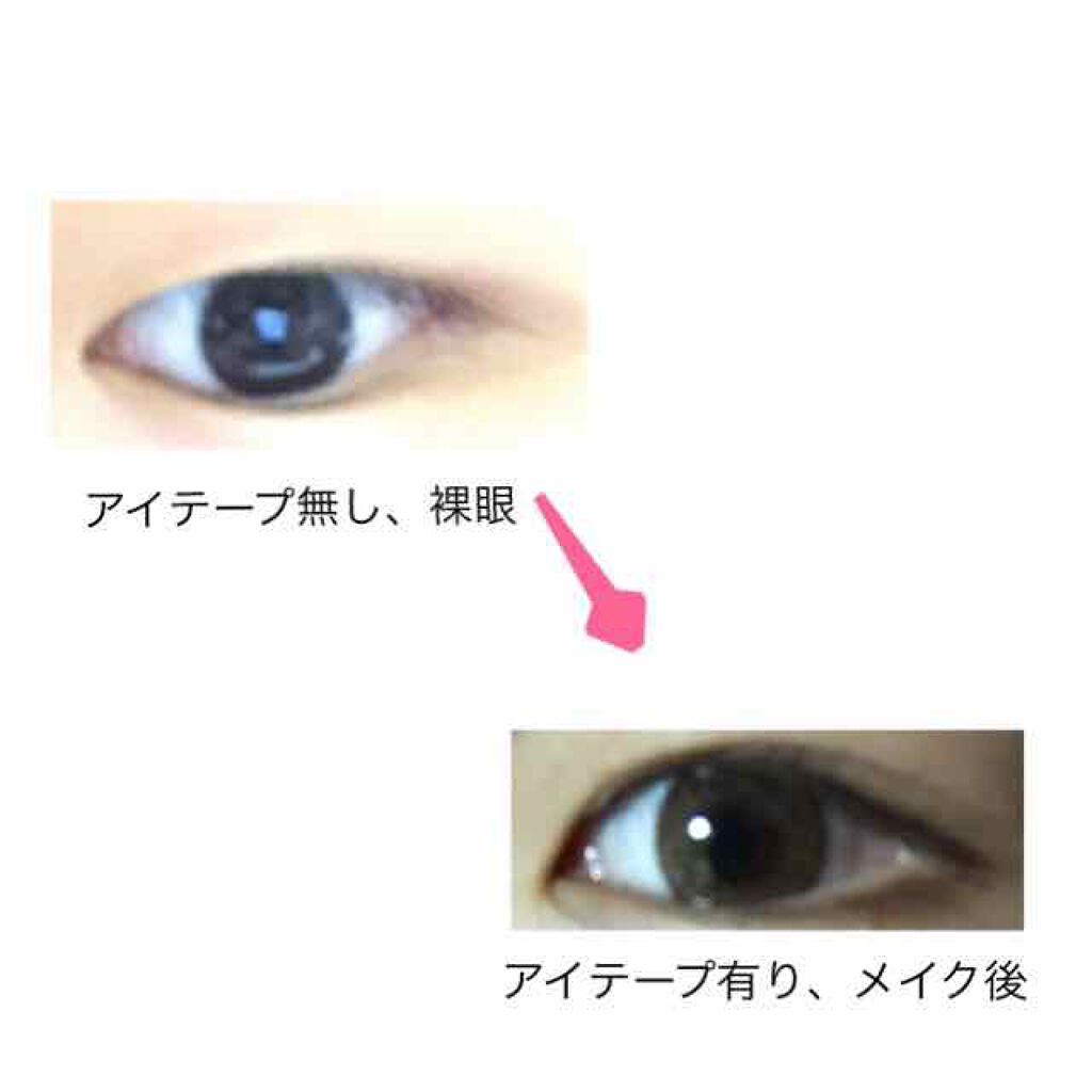 埋没式形成 くっきり二重テープ/DAISO/二重まぶた用アイテムを使ったクチコミ(2枚目)