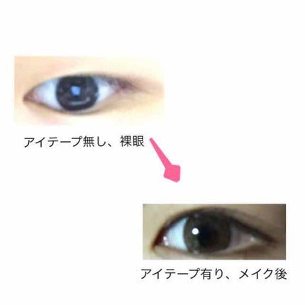 埋没式形成 くっきり二重テープ/DAISO/二重まぶた用アイテムを使ったクチコミ(2枚目)