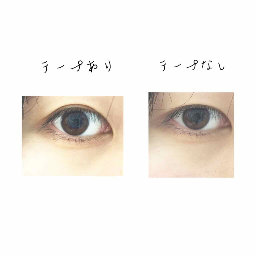 のびーるアイテープ(絆創膏タイプ、レギュラー)/DAISO/二重まぶた用アイテムを使ったクチコミ(2枚目)