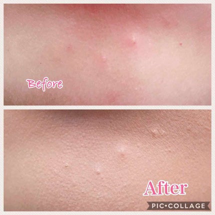 スポッツカバー ファウンデイション/SHISEIDO/クリームコンシーラーを使ったクチコミ(4枚目)