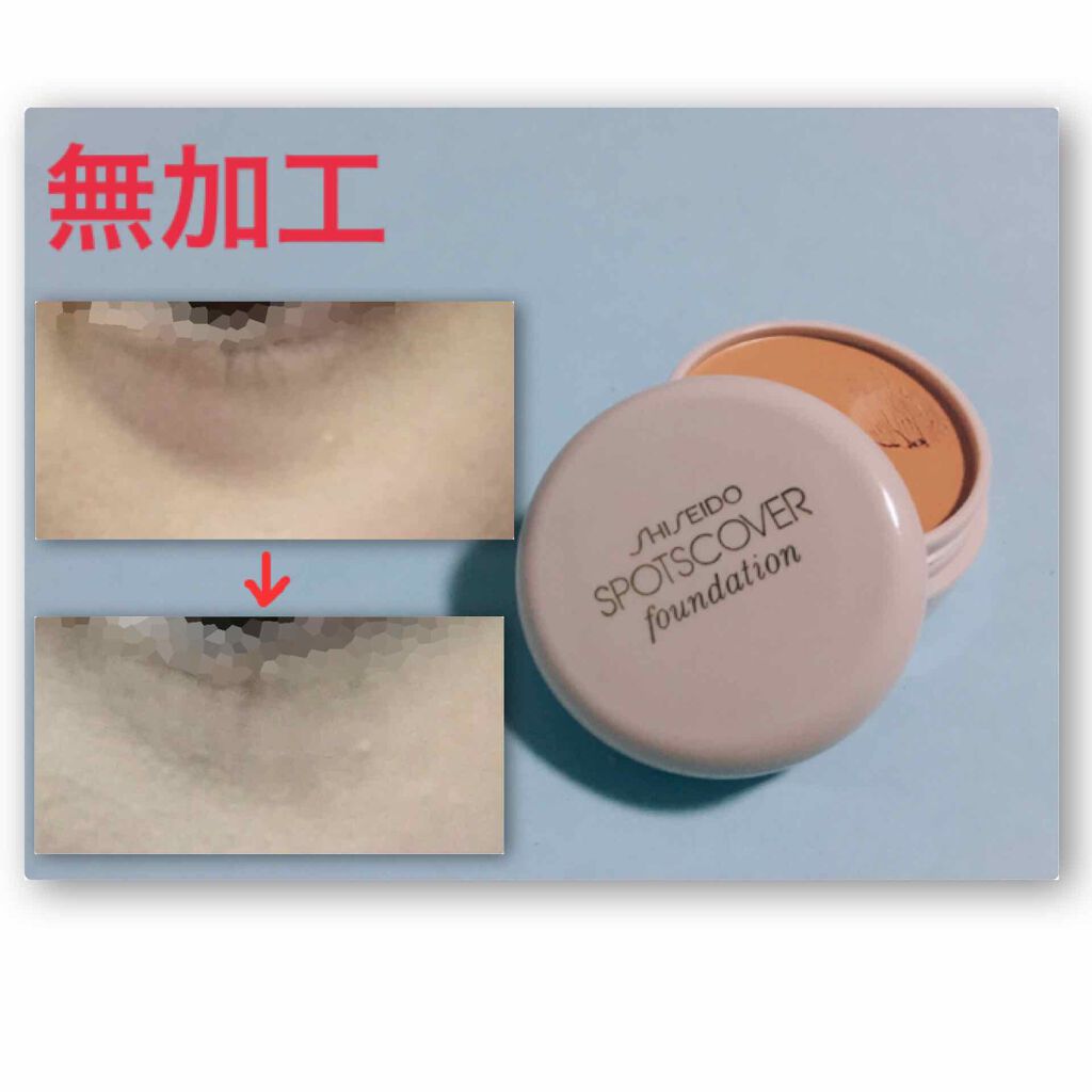 スポッツカバー ファウンデイション/SHISEIDO/クリームコンシーラーを使ったクチコミ(1枚目)