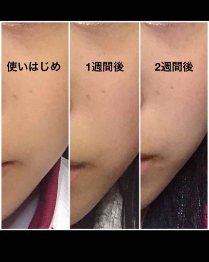 ヨックセラム セット/ナチュラルパシフィック/化粧水を使ったクチコミ(2枚目)