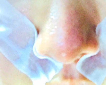 おうちdeエステ ピタッと密着コットンパック/ビオレ/シートマスク・パックを使ったクチコミ(4枚目)