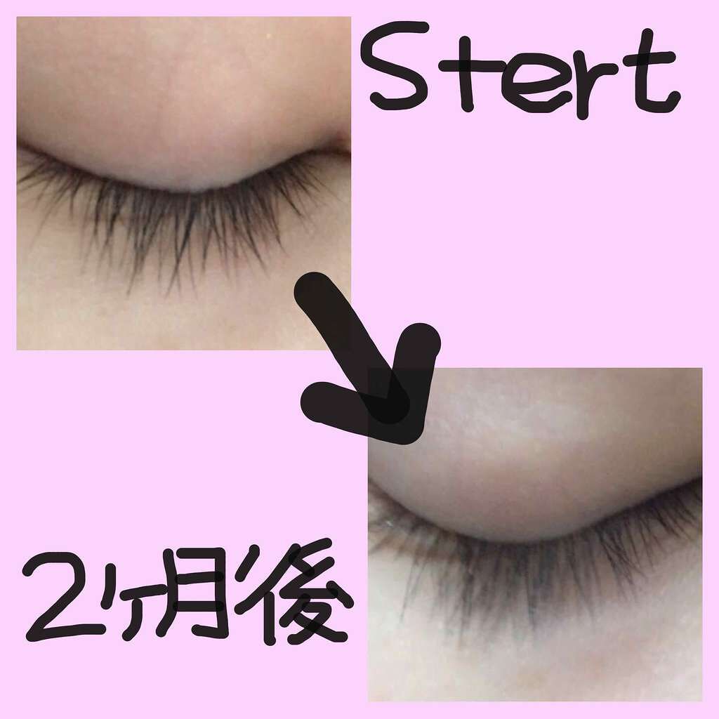 THE まつ毛美容液/UZU BY FLOWFUSHI/まつげ美容液を使ったクチコミ（2枚目）