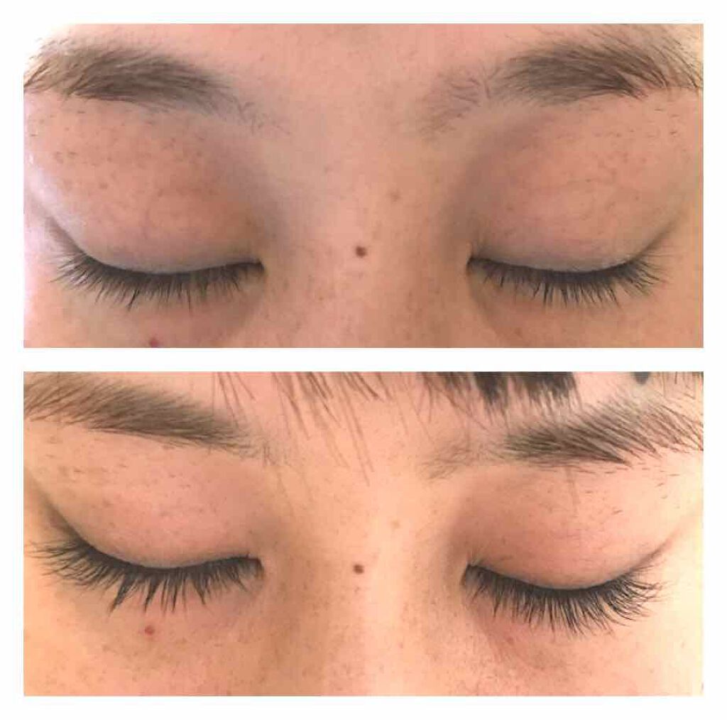 リバイタラッシュ アドバンス ジャパン/エム・アール・アイ/まつげ美容液を使ったクチコミ(1枚目)