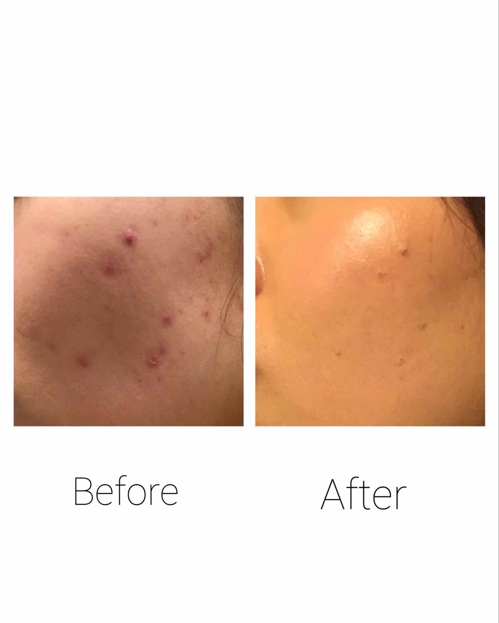 カバーパーフェクション チップコンシーラー/the SAEM/リキッドコンシーラーを使ったクチコミ(2枚目)