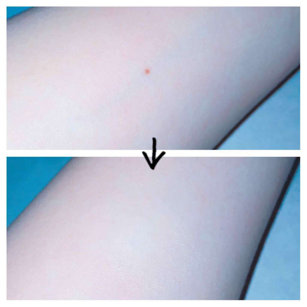 スポッツカバー ファウンデイション/SHISEIDO/クリームコンシーラーを使ったクチコミ（2枚目）