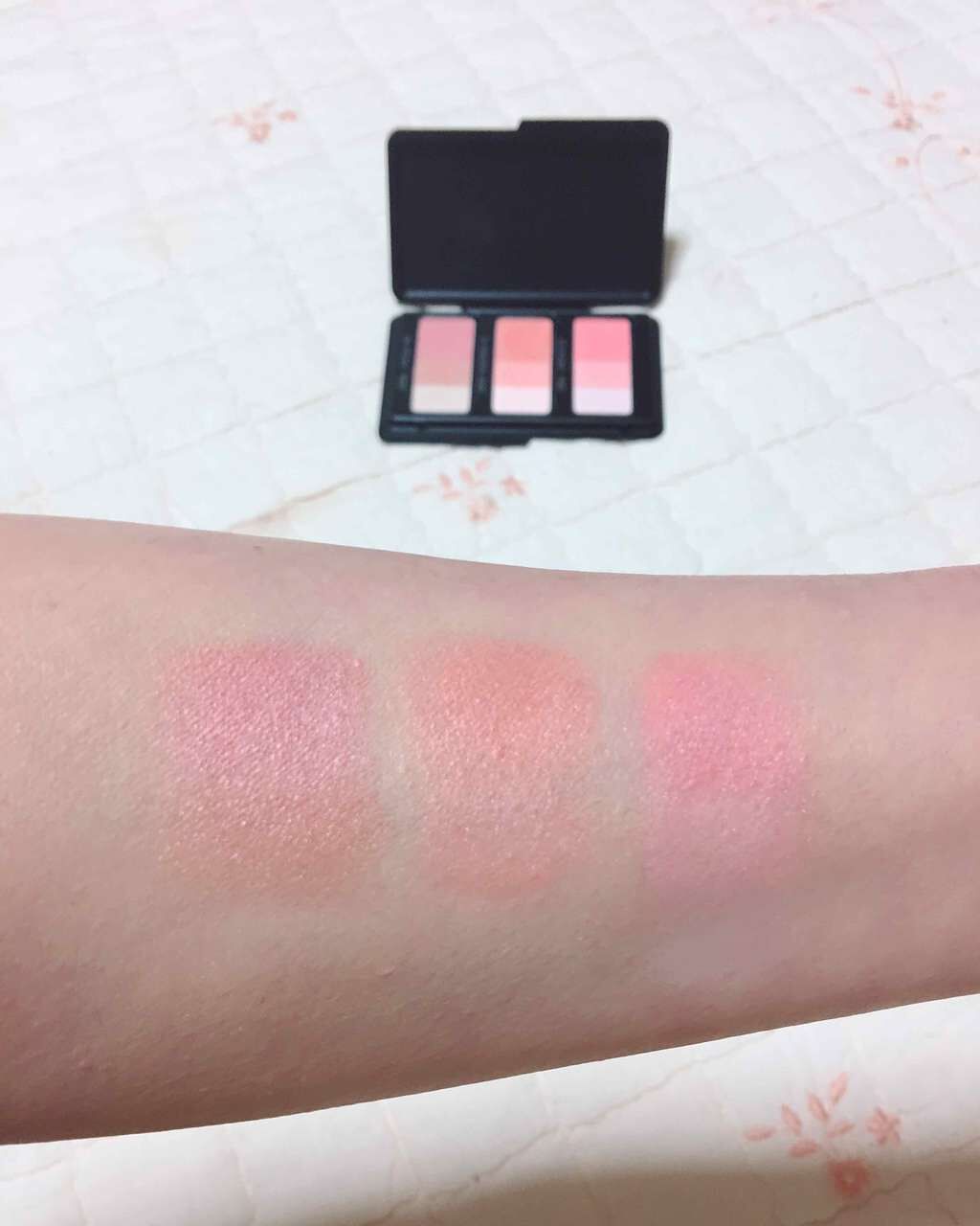 リンクルショット メディカル セラム/リンクルショット/アイケア・アイクリームを使ったクチコミ（2枚目）