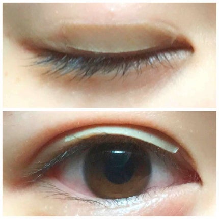 絆創膏/その他を使ったクチコミ(3枚目)