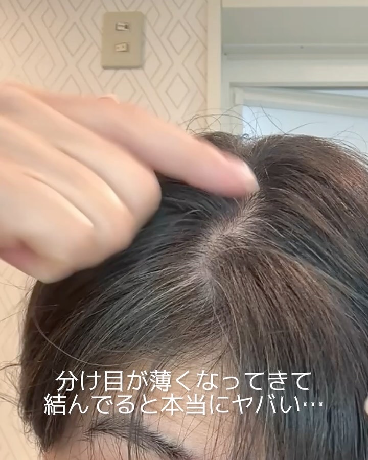 薬用育毛剤HG-101/フローラ/頭皮ローションの動画クチコミ1つ目