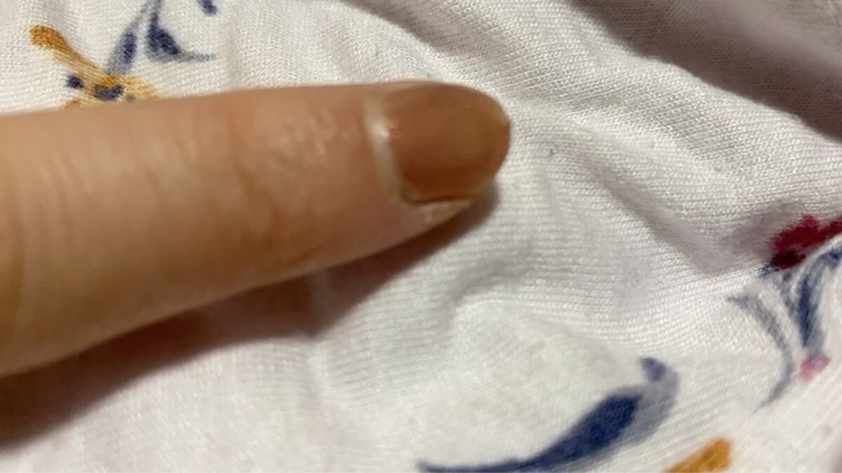 クイック＆イージーリムーバー/キャンメイク/除光液を使ったクチコミ（2枚目）