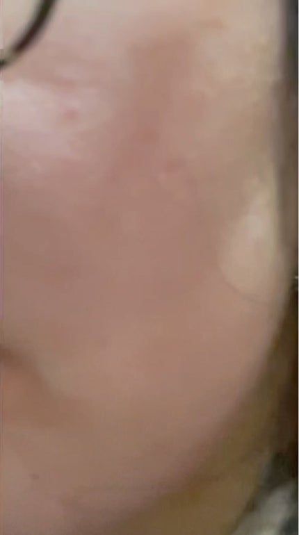 重曹泡洗顔/毛穴撫子/泡洗顔を使ったクチコミ(1枚目)