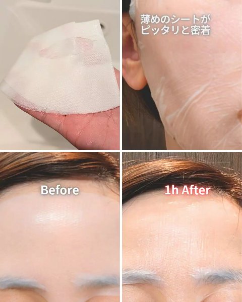 トラブルパッチマスク/EIOM/その他スキンケアを使ったクチコミ（3枚目）