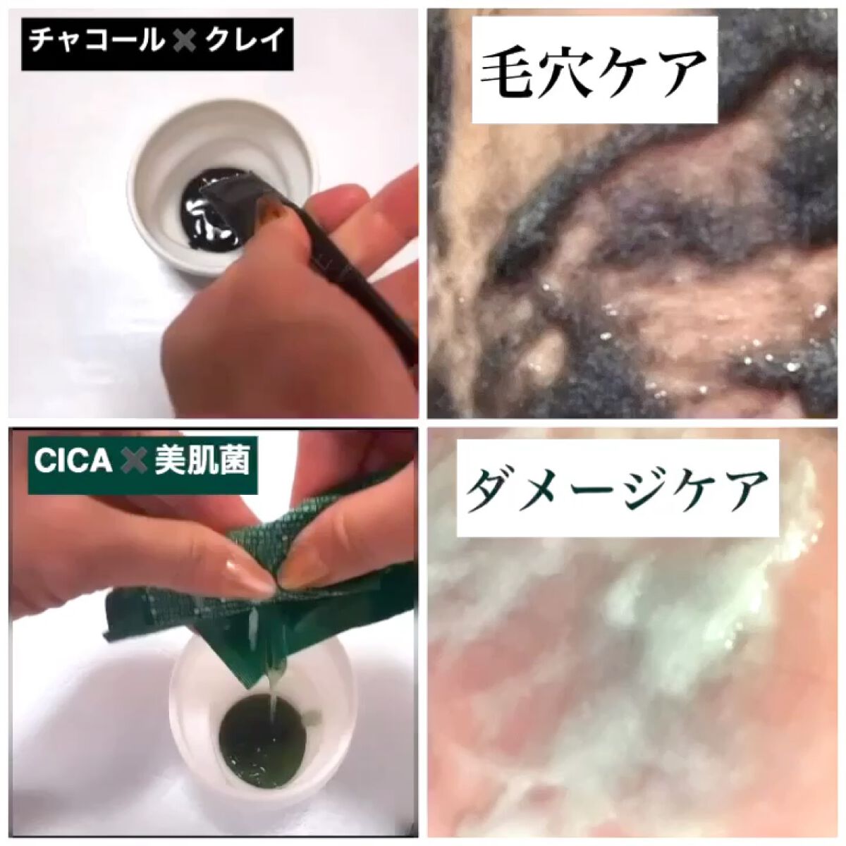 ニードル炭酸パック/NNE/洗い流すパック・マスクを使ったクチコミ（2枚目）