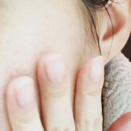 クリアブライトエッセンス/NIAVITA/美容液を使ったクチコミ(3枚目)