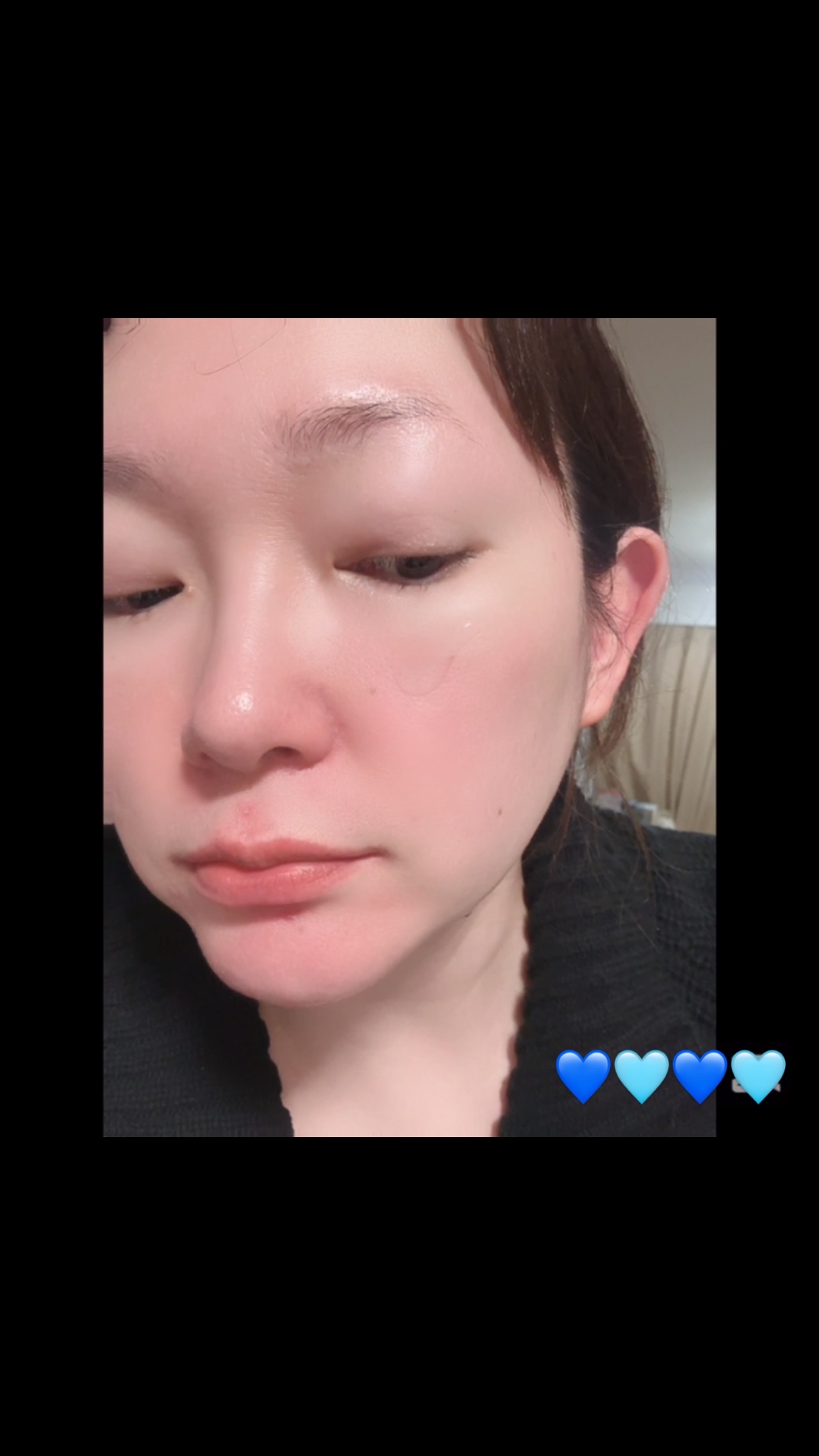 ハイドラAアンプル/Dr.lonnie/美容液の人気ショート動画