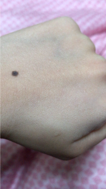 マットパウダー/CHICAY CHICO/ルースパウダーを使ったクチコミ（3枚目）