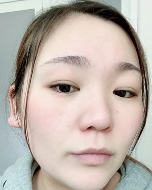 ナチュラルクッションピーリング/アカラン/ピーリングの動画クチコミ3つ目