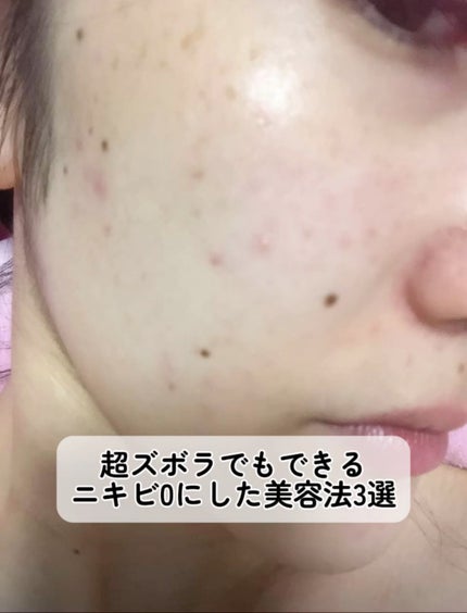 試してみた】エンビロン モイスチャークリーム4の効果・肌質別の 試してみた】エンビロン モイスチャークリーム4の効果・肌質別の