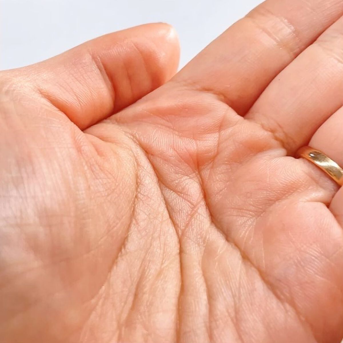 シカテロルトナー/beplain/化粧水を使ったクチコミ（3枚目）