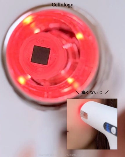 メリタンショットガン/セルオロジー/美顔器・マッサージを使ったクチコミ(7枚目)