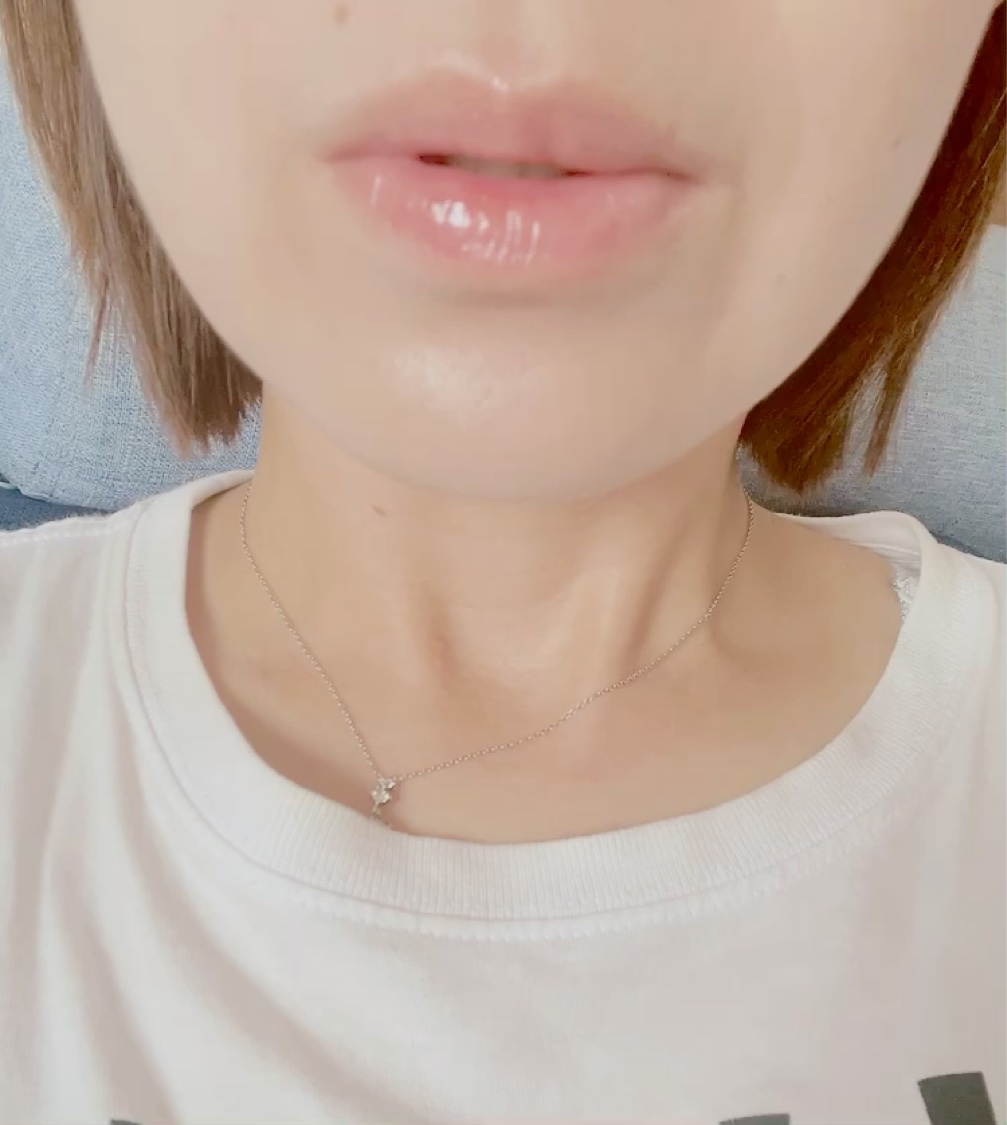 エッセンス リッププランパー/Visée/リッププランパーを使ったクチコミ（3枚目）