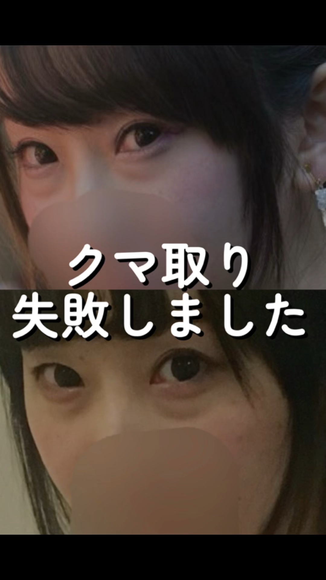 ラディアントクリーミーコンシーラー/NARS/リキッドコンシーラーを使ったクチコミ（1枚目）