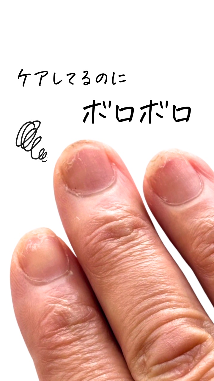 最近、爪先がボロボロで
「ちゃんとケアしてるのに…」
と感じている人、実はとても多いです。

特に冬は
✔ 乾燥
✔ 水仕事
✔ 摩擦
が重なって、爪にとっては過酷な季節。

でも、今の状態で
「もうダメかも」と思わなくて大丈夫。

爪は、