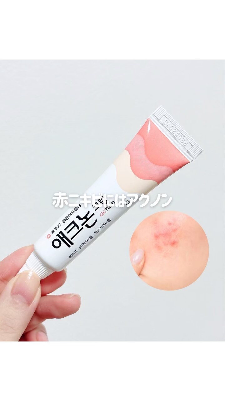 アクノンクリーム/東亜製薬/その他スキンケアの動画クチコミ3つ目