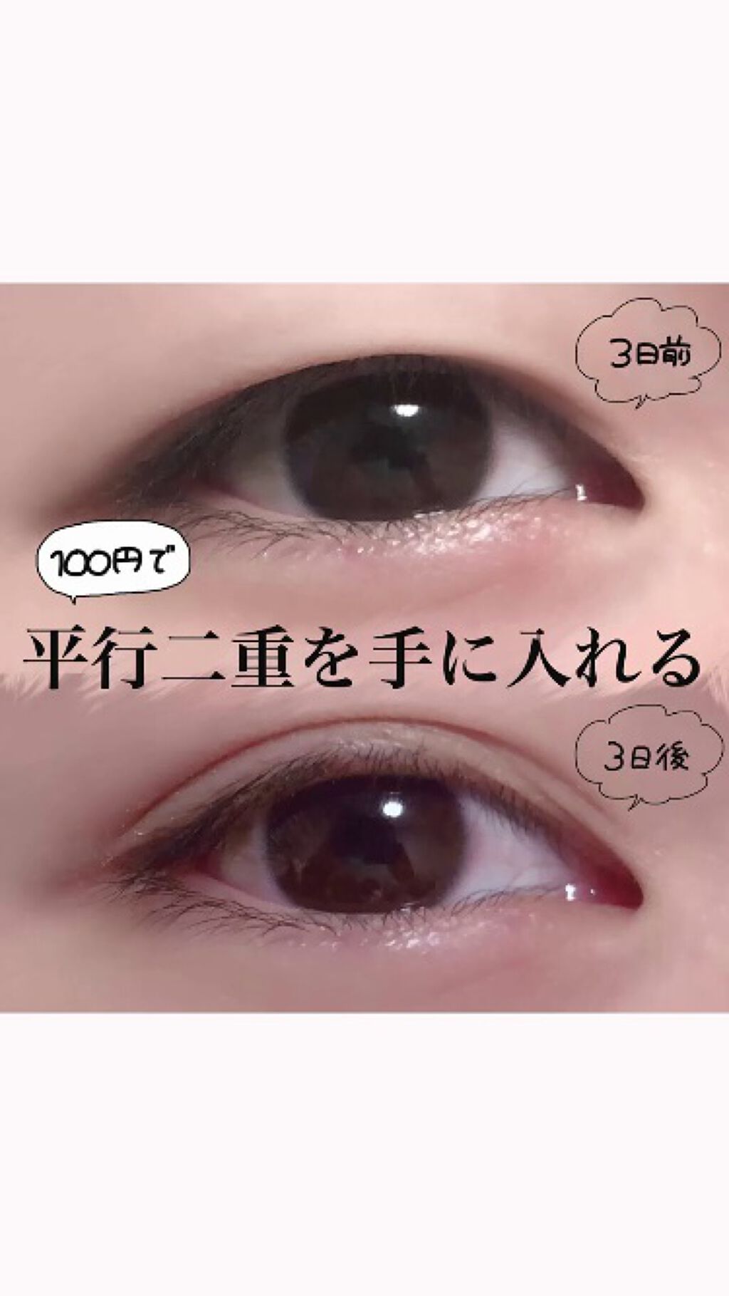 のびーるアイテープ（絆創膏タイプ、レギュラー）/DAISO/二重まぶた用アイテムの人気ショート動画