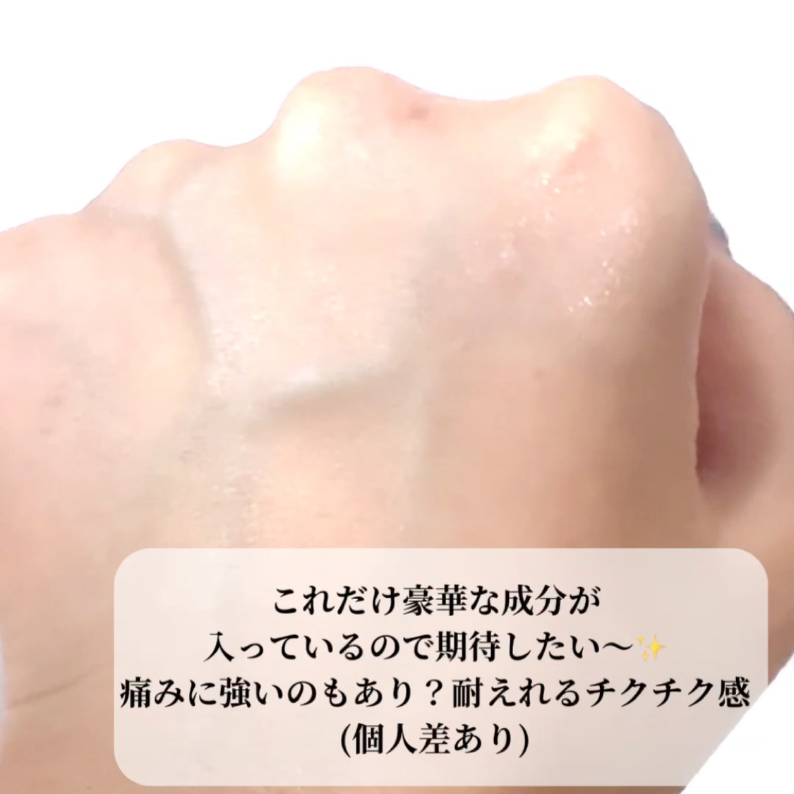 リードルリッチ パワーニードルセラム/REEDLE RICH/美容液を使ったクチコミ（3枚目）