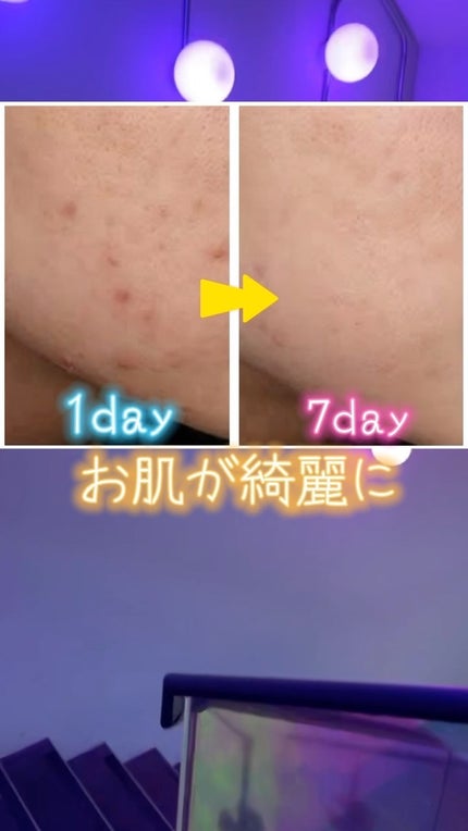 ビタC グリーンティーエンザイム ブライト セラム/innisfree/美容液の人気ショート動画