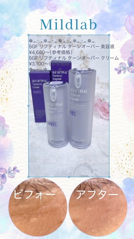 5GF リフティナル ターンオーバー クリーム /次世代レチノール/Mildlab/フェイスクリームの人気ショート動画