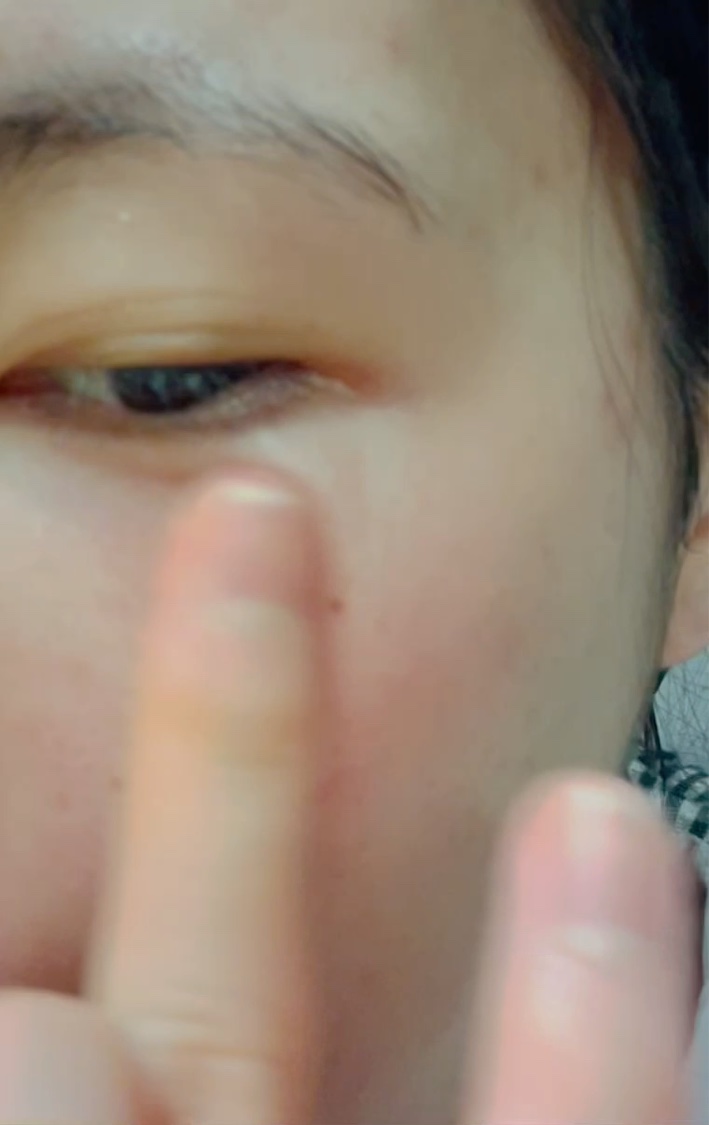 レチノール エキスパート0.1%/IOPE/美容液を使ったクチコミ（3枚目）