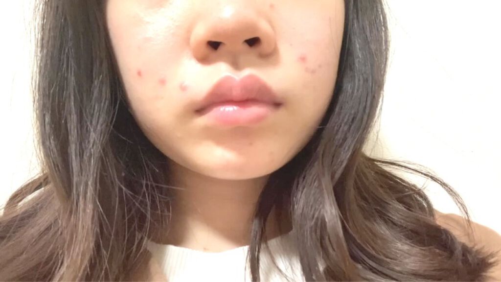 明色美顔水 薬用化粧水/美顔/化粧水を使ったクチコミ（1枚目）