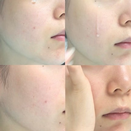 ãã¥ã¢ã« ãšãã§ã¯ã ã¢ã³ãã«/REJURAN COSMETICS/çŸå®¹æ¶²ã䜿ã£ãã¯ãã³ãïŒ3æç®ïŒ