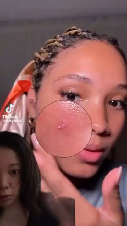 ガーリックリードルショット ジェルクリーム/VT/フェイスクリームの動画クチコミ3つ目