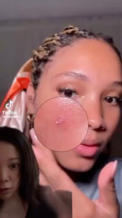 ガーリックリードルショット ジェルクリーム/VT/フェイスクリームの人気ショート動画