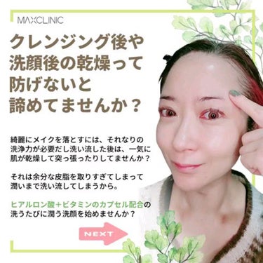 MAXCLINIC ヒアルロンビタオイルフォームのクチコミ「高濃度ビタミンCのカプセルが見える！🧪✨
すっきりあらってヒアルロン酸でしっとり洗顔✨

@m.....」（2枚目）