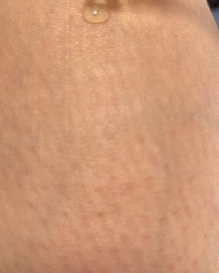 ナイアシンアミドブレミッシュケアセラム/ONE THING/美容液を使ったクチコミ（3枚目）