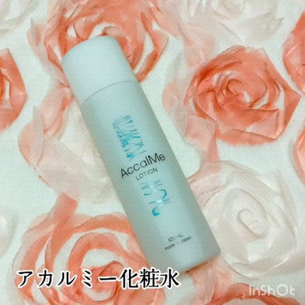 アカルミー化粧水/ワイズ/化粧水の人気ショート動画