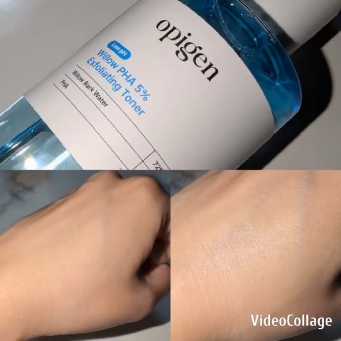 ウィロウPHA5%角質ケアトナー/opigen/化粧水を使ったクチコミ（2枚目）