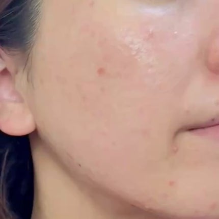 I.P.IライトマックスAPマスクEX/MEDIHEAL/シートマスク・パックを使ったクチコミ(6枚目)