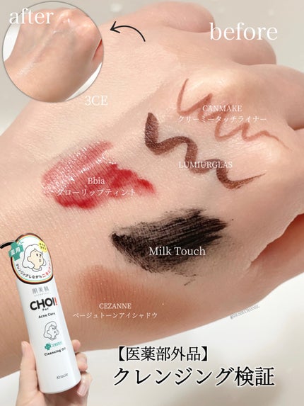 CHOIクレンジングオイル 薬用ニキビケア/肌美精/オイルクレンジングの人気ショート動画